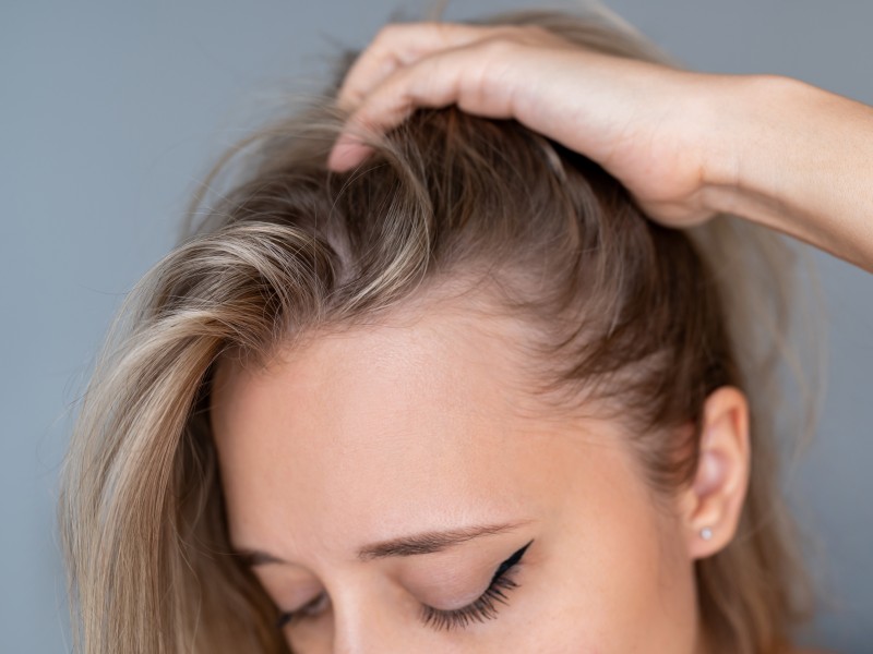 Frau mit langen blonden Haaren kratzt sich am Kopf